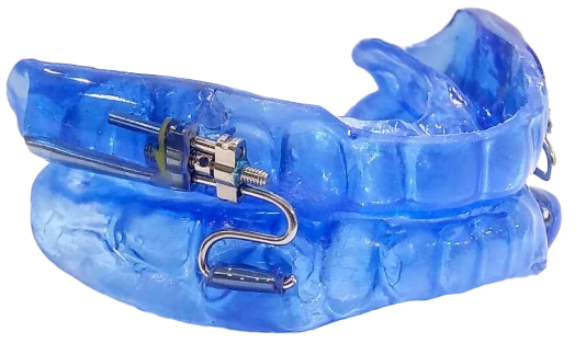 Aparelho Intraoral